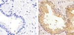 TIMP1 Antibody in Immunohistochemistry (Paraffin) (IHC (P))