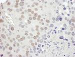 MSH2 Antibody in Immunohistochemistry (IHC)