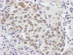 MSH2 Antibody in Immunohistochemistry (IHC)