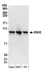 MSH2 Antibody in Western Blot (WB)