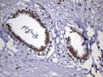 MSH2 Antibody in Immunohistochemistry (Paraffin) (IHC (P))