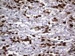 MSH2 Antibody in Immunohistochemistry (Paraffin) (IHC (P))