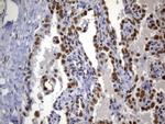 MSH2 Antibody in Immunohistochemistry (Paraffin) (IHC (P))