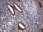 MSH2 Antibody in Immunohistochemistry (Paraffin) (IHC (P))