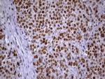 MSH2 Antibody in Immunohistochemistry (Paraffin) (IHC (P))