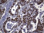 MSH2 Antibody in Immunohistochemistry (Paraffin) (IHC (P))