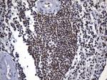 MSH2 Antibody in Immunohistochemistry (Paraffin) (IHC (P))