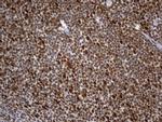 MSH2 Antibody in Immunohistochemistry (Paraffin) (IHC (P))