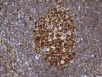 MSH2 Antibody in Immunohistochemistry (Paraffin) (IHC (P))