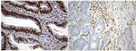 MSH2 Antibody in Immunohistochemistry (Paraffin) (IHC (P))