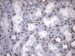 MSH2 Antibody in Immunohistochemistry (Paraffin) (IHC (P))