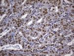 MSH2 Antibody in Immunohistochemistry (Paraffin) (IHC (P))