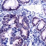 MSH2 Antibody in Immunohistochemistry (Paraffin) (IHC (P))