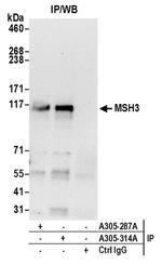 MSH3 Antibody in Western Blot (WB)