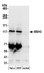 MSH3 Antibody in Western Blot (WB)