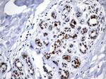 MSH6 Antibody in Immunohistochemistry (Paraffin) (IHC (P))