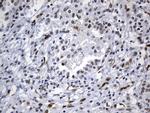 MSH6 Antibody in Immunohistochemistry (Paraffin) (IHC (P))