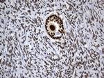 MSH6 Antibody in Immunohistochemistry (Paraffin) (IHC (P))