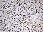 MSH6 Antibody in Immunohistochemistry (Paraffin) (IHC (P))