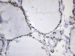 MSH6 Antibody in Immunohistochemistry (Paraffin) (IHC (P))