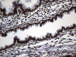 MSH6 Antibody in Immunohistochemistry (Paraffin) (IHC (P))