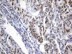 MSH6 Antibody in Immunohistochemistry (Paraffin) (IHC (P))