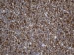 MSH6 Antibody in Immunohistochemistry (Paraffin) (IHC (P))