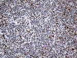 MSH6 Antibody in Immunohistochemistry (Paraffin) (IHC (P))