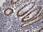 MSH6 Antibody in Immunohistochemistry (Paraffin) (IHC (P))