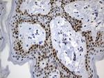 MSH6 Antibody in Immunohistochemistry (Paraffin) (IHC (P))