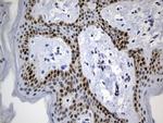 MSH6 Antibody in Immunohistochemistry (Paraffin) (IHC (P))