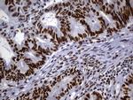 MSH6 Antibody in Immunohistochemistry (Paraffin) (IHC (P))