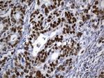 MSH6 Antibody in Immunohistochemistry (Paraffin) (IHC (P))