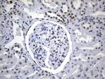 MSH6 Antibody in Immunohistochemistry (Paraffin) (IHC (P))