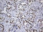 MSH6 Antibody in Immunohistochemistry (Paraffin) (IHC (P))