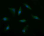 MSI2 Antibody in Immunocytochemistry (ICC/IF)