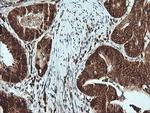 MSI2 Antibody in Immunohistochemistry (Paraffin) (IHC (P))