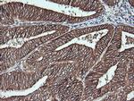 MSI2 Antibody in Immunohistochemistry (Paraffin) (IHC (P))