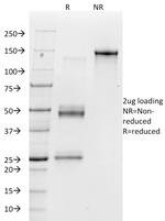 Vitronectin Receptor/CD51/CD61 Antibody in SDS-PAGE (SDS-PAGE)