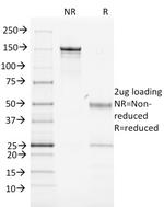 MHC II Antibody in SDS-PAGE (SDS-PAGE)