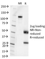 Pseudomonas aeruginosa serotype 6C Antibody in SDS-PAGE (SDS-PAGE)