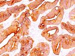 Cytokeratin, Multi (Epithelial Marker) Antibody in Immunohistochemistry (Paraffin) (IHC (P))