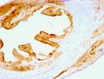 Cytokeratin, Multi (Epithelial Marker) Antibody in Immunohistochemistry (Paraffin) (IHC (P))