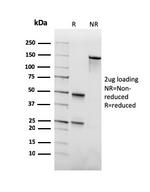 Biotin (Vitamin B7 or Vitamin H) Antibody in SDS-PAGE (SDS-PAGE)