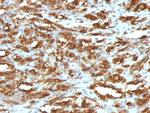 Actin, Muscle Specific (Muscle Cell Marker) Antibody in Immunohistochemistry (Paraffin) (IHC (P))