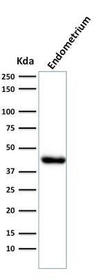 Actin, Muscle Specific (Muscle Cell Marker) Antibody in Western Blot (WB)