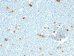 Macrophage, pan (Histiocytoma and Sebocyte Marker) Antibody in Immunohistochemistry (Paraffin) (IHC (P))