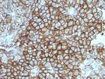KBA.62 (Melanoma Associated Antigen) Antibody in Immunohistochemistry (Paraffin) (IHC (P))