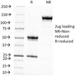 KBA.62 (Melanoma Associated Antigen) Antibody in SDS-PAGE (SDS-PAGE)