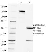 Rabies Virus Antibody in SDS-PAGE (SDS-PAGE)